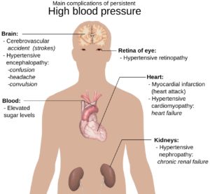 Negative Effects of Hypertension